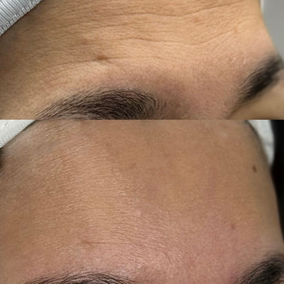 Bellarè Menopause Sculptor™