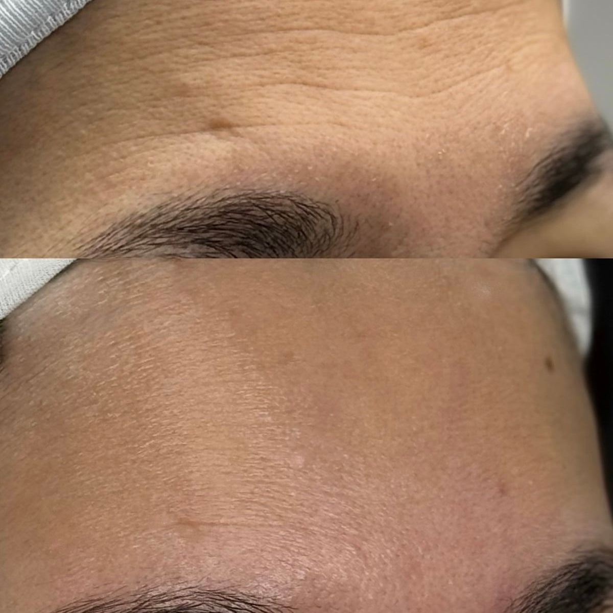 Bellarè Menopause Sculptor™