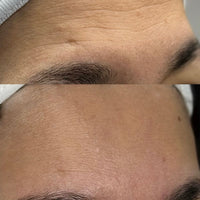 Bellarè Menopause Sculptor™