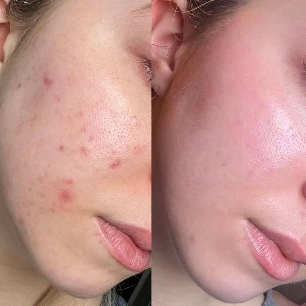 Bellarè Menopause Sculptor™