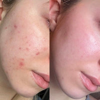 Bellarè Menopause Sculptor™