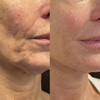 Bellarè Menopause Sculptor™